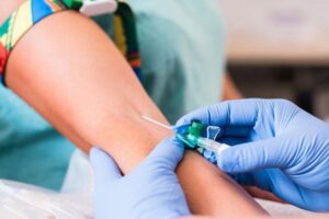 STD test singapore